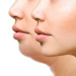 Body Contouring - Health360 Faisalabad Body Contouring - Health360 Faisalabad