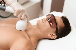 Laser hair removal for men at Health360