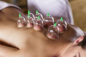 Top-rated Hijama Center in Faisalabad for Reliable and Effective Treatment