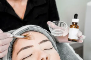 Chemical peeling treatment at Health360