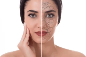 Dry skin dermatology care