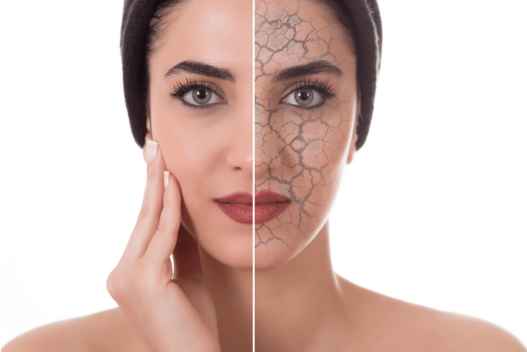 Health360 Dry Skin Health360 Faisalabad