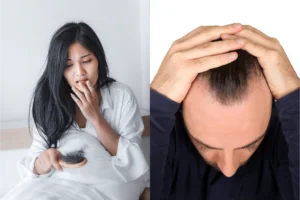 Hair loss treatment at Health360