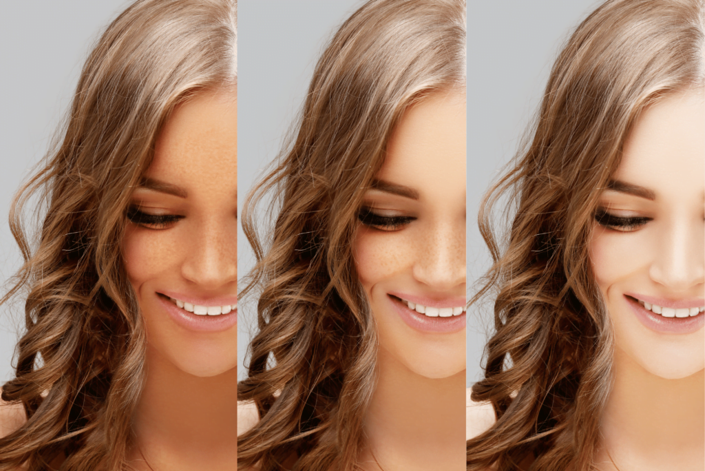 Affordable Whitening Injection Price in Faisalabad