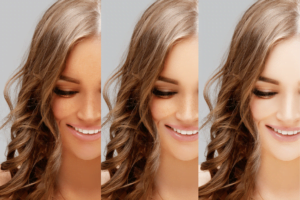 Affordable Whitening Injection Price in Faisalabad