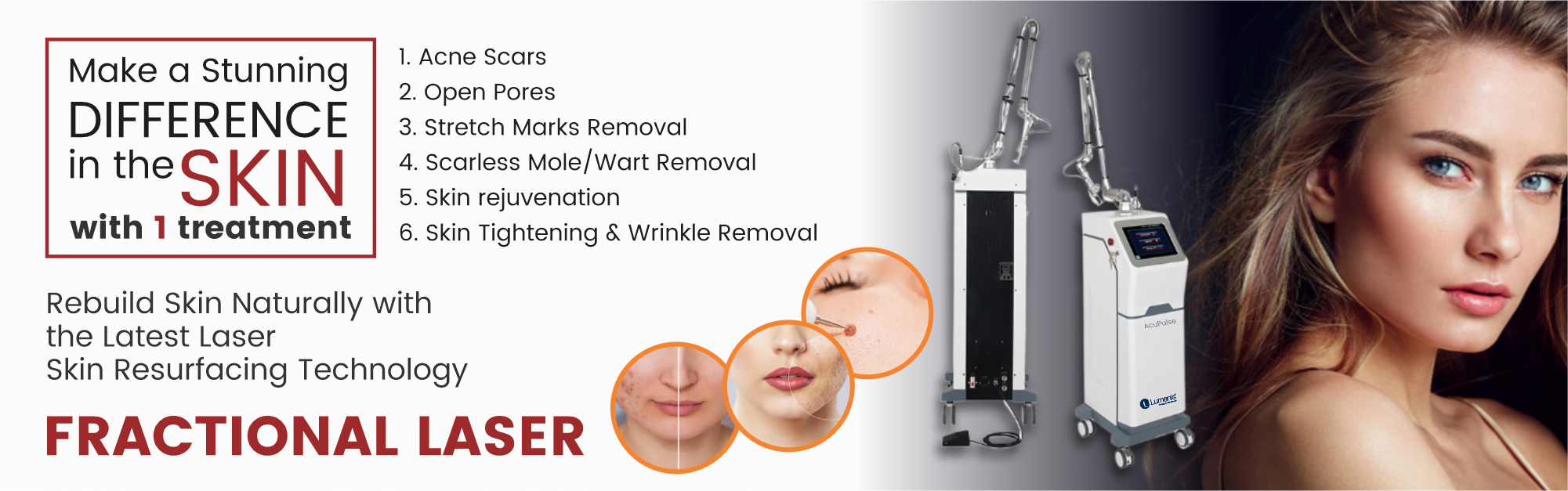 Fractional laser png