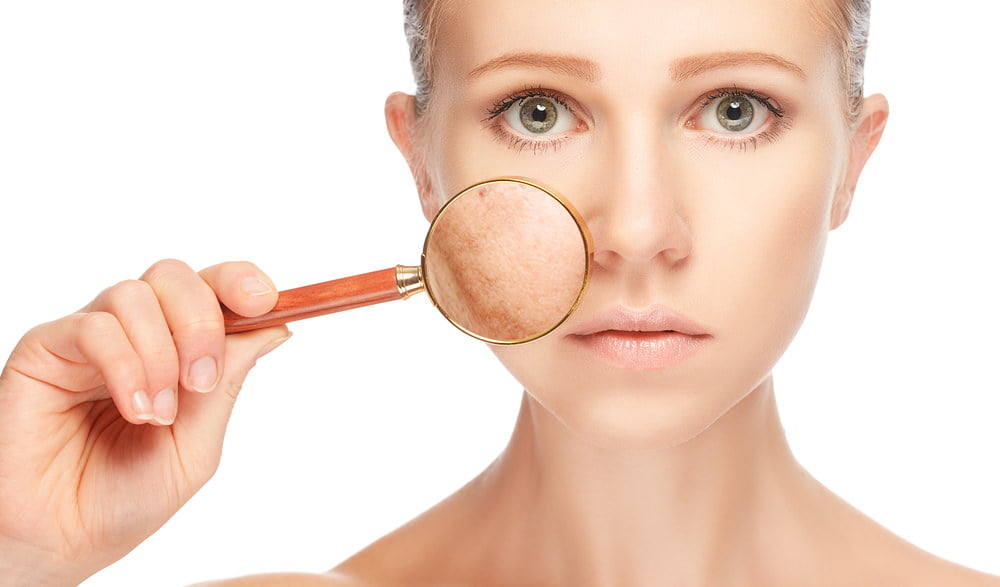 Skin Pigmentation - Health360 Faisalabad