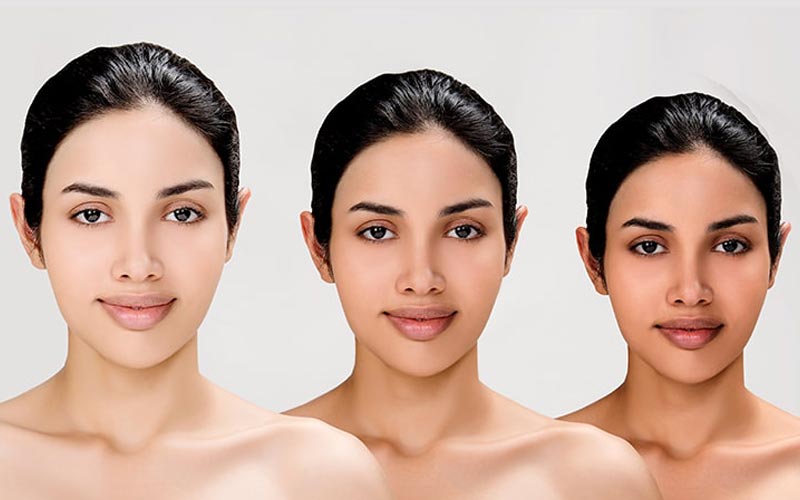 Acne Treatment - Health360 Faisalabad