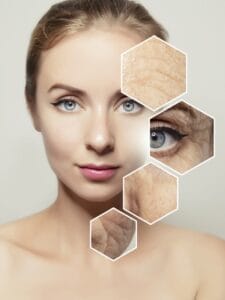 Dermatologist Faisalabad For Acne Treatment