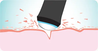 OxyGeneO Facial - Health360 Faisalabad OxyGeneO Facial - Health360 Faisalabad