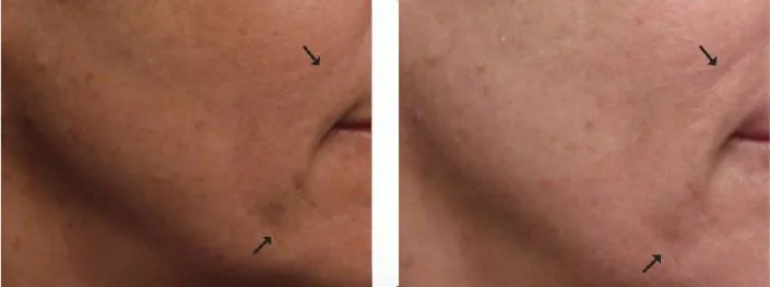 OxyGeneO Facial - Health360 Faisalabad OxyGeneO Facial - Health360 Faisalabad