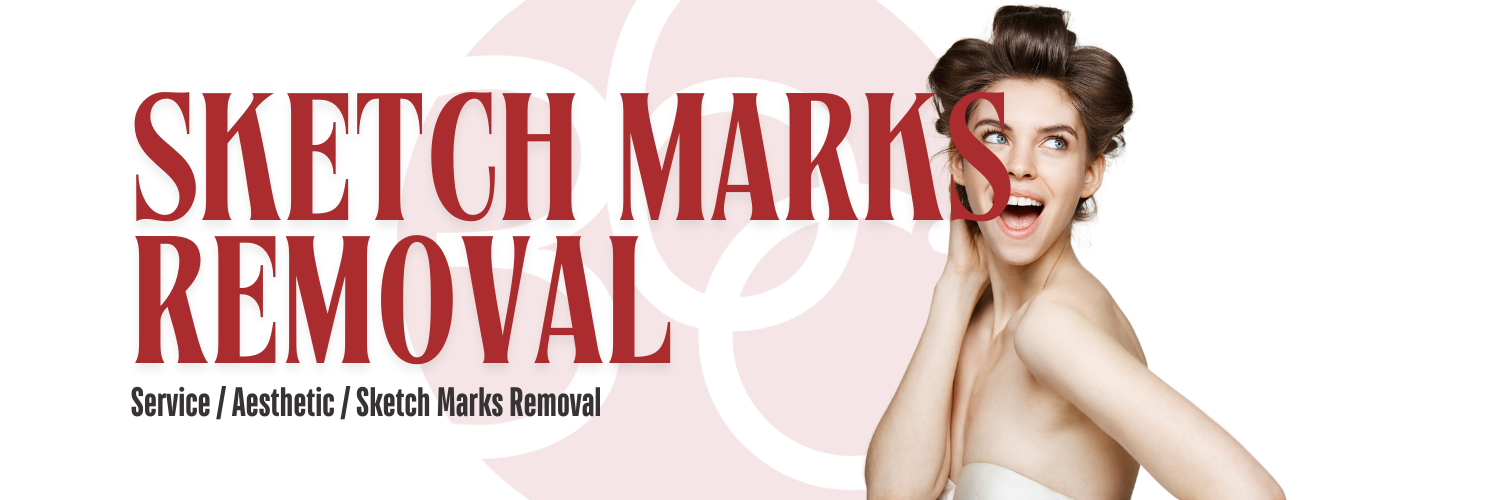 Sketch Marks Removal - Health360 Faisalabad Sketch Marks Removal - Health360 Faisalabad