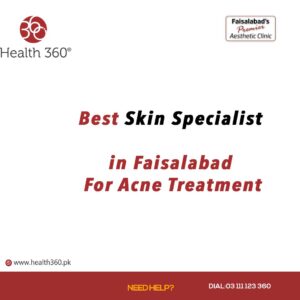 Best Skin Specialist in Faisalabad For Acne Treatment