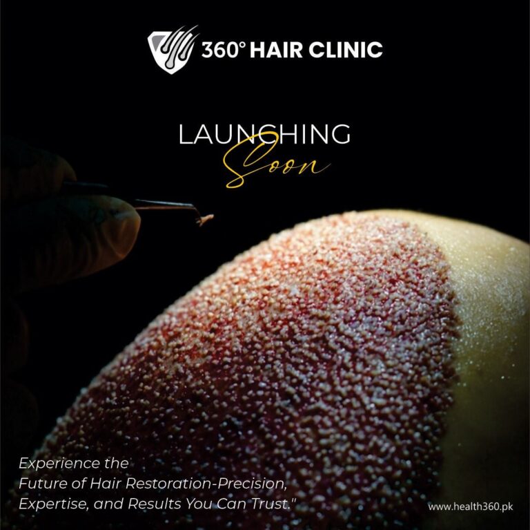 Best Hair Transplant Clinic in Faisalabad