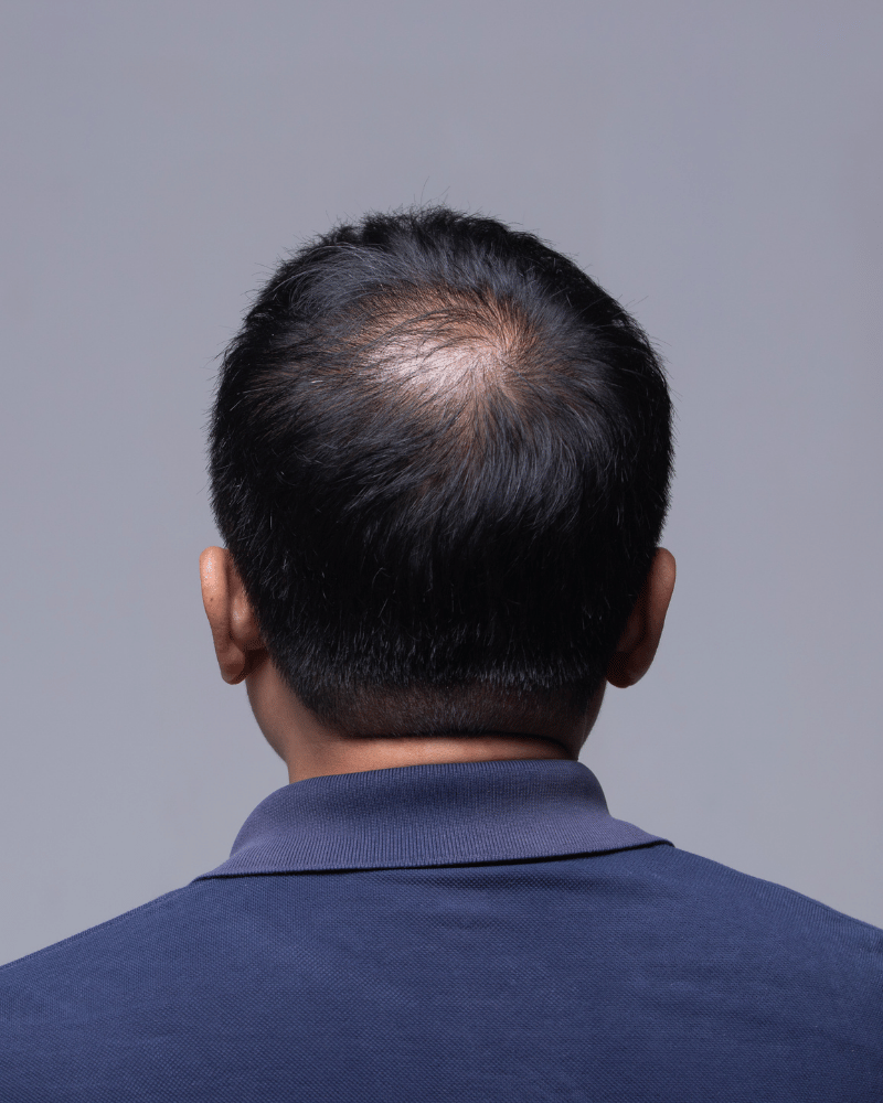 Aesthetic - Health360 Faisalabad Aesthetic - Health360 Faisalabad