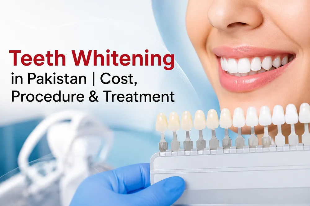 Teeth Whitening in Pakistan | Cost, Procedure & Treatment in Faisalabad and Islamabad