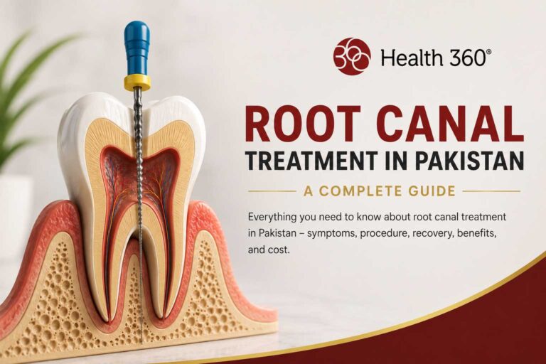 Root Canal Treatment in Pakistan Health360 Faisalabad & Islamabad