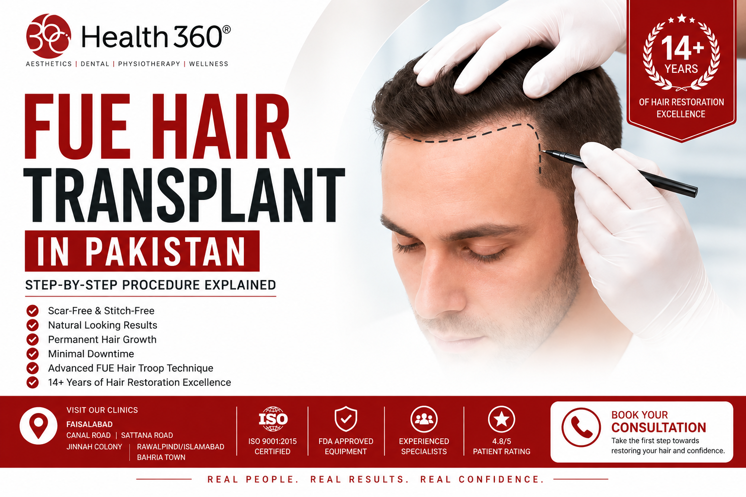 FUE Hair Transplant in Pakistan Step-by-Step Procedure Explained